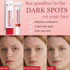 2Pcs Freckle Removal Cream, Dark Spot Remover for Face and