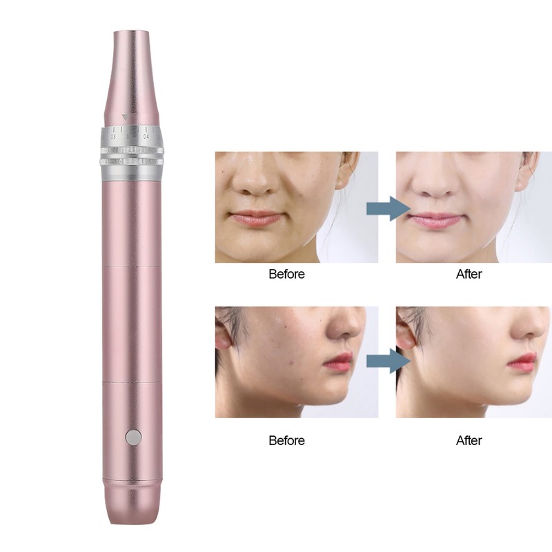 Electric Micro Needle Pen Anti-Aging Skin Repairing Spot Removing Beauty