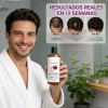 2pzs Shampoo Lexenic Excalvo Con Cebolla Y Aceite De Romer
