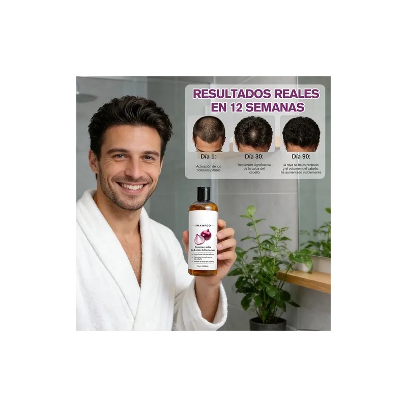 2pzs Shampoo Lexenic Excalvo Con Cebolla Y Aceite De Romer