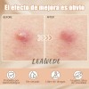 🔥 240pzs mascarillas estrella para el acne espinillas granos Vitaminas