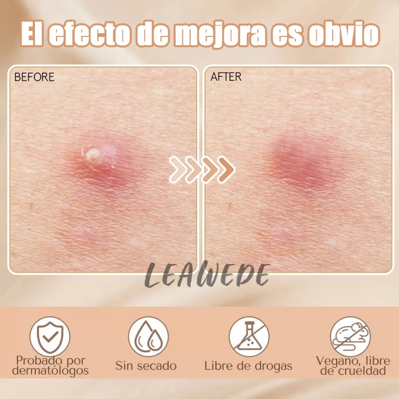 🔥 240pzs mascarillas estrella para el acne espinillas granos Vitaminas