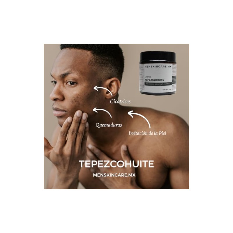 100g Crema Tepezcohuite Fórmula Natural Regeneración Cutánea Cicatrices Nutre Hidrata