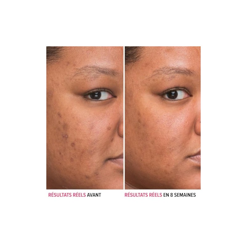 It Cosmetics Bye bye Dark Spots, Serum, Suero 4% Niacinamida