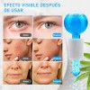 Masaje Facial Con Bola De Hielo Y Tratamiento Para Ojos
