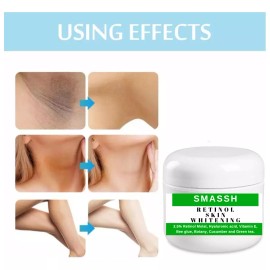 Smassh Crema Blanqueadora Con Retinol, Té Verde, Ácido Hialurónico