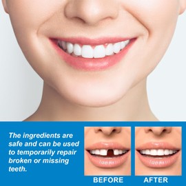 Temporary Tooth Repair Kits, Easy & Qucik Moldable False Teeth, Replacement Repair Beads, Treval Size Temporary Tooth Filling Kit, Thermal Forming DIY Teeth Repairs Granules, 30g