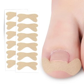 Zanchara Ingrown Toenail Treatment, 60Pcs Breathable Ingrown Toenail Strips,Painless Ingrown Toenail Tool for Nail Removal & Care, At-Home Pedicure Solution (Shape E)