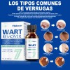 Líquida De Eliminación De Verrugas Y Mezquinos 30ml