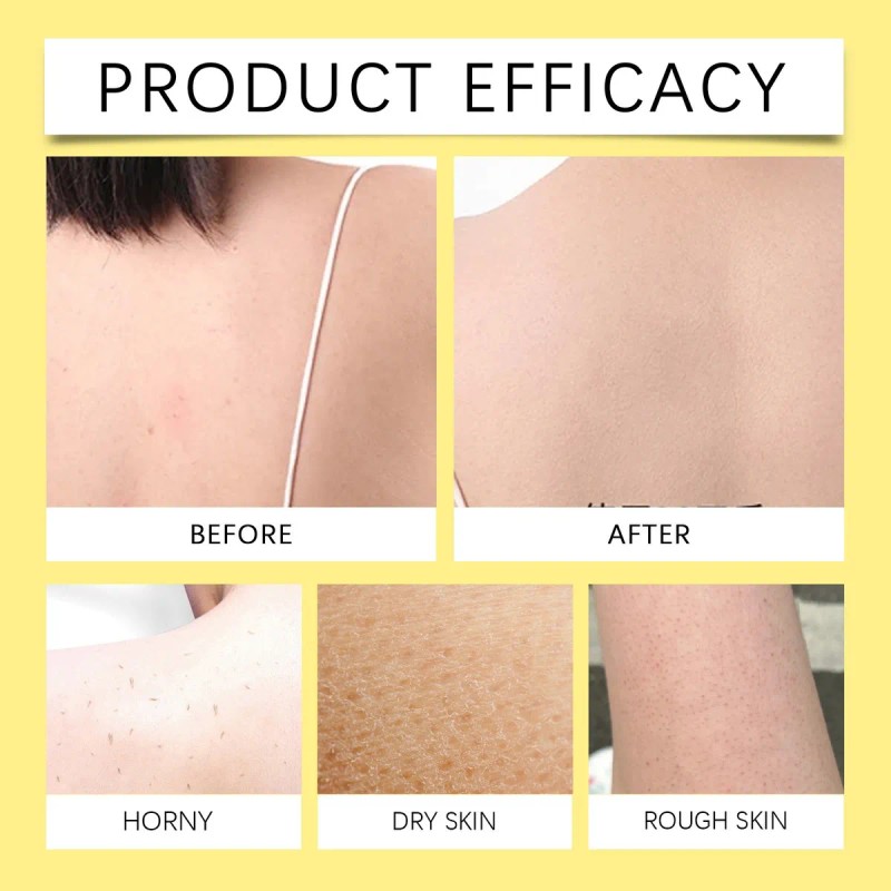 Calmante E Hidratante Natural Para Rostro Y Cuerpo De S