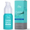 Navabelle Dark Spot Serum: Advanced Hyperpigmentation Treatment for Face and Body - Targets Melasma, Freckles, Sun Spots, Blemishes, and Brown Spots - Suitable for Women & Men
