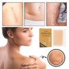 Tattoo Cover Up Sticker Skin Scar Cover Tap, Ultra-Thin Patch,