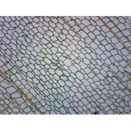 EISCO (Pack of 10) Cork Cells, Cross Section - Prepared Microscope Slides - Classroom Pack, 10 Slides in Storage Case - Biology & Microscopy