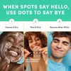 Dots for Spots Acne Patches - Pack of 60 Translucent