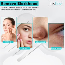 Mitesserentferner Pickel Ausdrücken Werkzeug Set 5 Stk Edelstahl, Pickelentferner Komedonenquetscher Blackhead Remover Pimple Popper Milien Entferner Akne Mitesser Extractor Porenreiniger Pinzetten