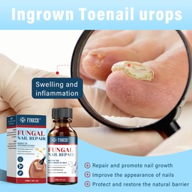 30ml Nagelpflege Lösung,Nagelpflege pflegend Serum,Nagelpflegeöl,NägelReparatur,Reduziert Risse & Verfärbungen,Schutz & Stärkung brüchiger Nägel,Nail Essence Serum Mit Bürsten