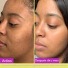 Good Molecules Glycolic Exfoliating Toner 120ml/4oz - Facial Toner and