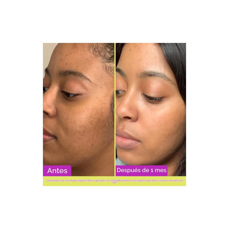 Good Molecules Glycolic Exfoliating Toner 120ml/4oz - Facial Toner and