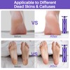 Electric Foot Callus Remover, 2-in-1 Electric Foot Filer/Nail Filer, Callus