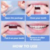 iwontalersy Pack of 14 Teeth Whitening Strips, Teeth Whitening Strips,
