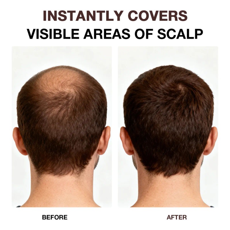 Polvo Para Volumen Cabello Maquillaje Fibra Capilar Cubre Ra