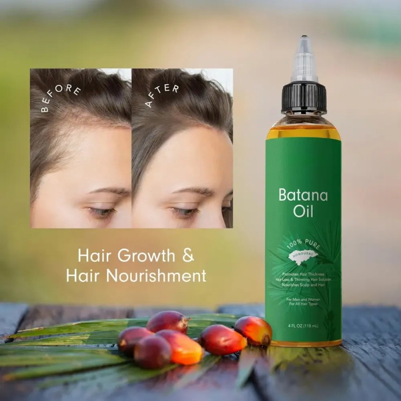 ( Aceite De Batana Para Las Raíces Del Cabello