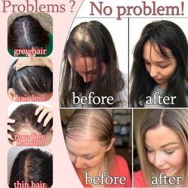 RICH BRIA Human Hair Toppers for Women with Thinning, Real Toppers for Womens Real Human Hair for Hairloss Greyhair