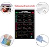 Chart Patterns & Candlestick Patterns Poster - Perfect for Trader
