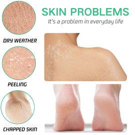 40% Urea Foot Cream - Ultra Moisturizing Urea Foot Cream Plus Deeply Hydrating - 2% Salicylic Acid Urea Cream - Foot Cream for Cracked Heels and Dry Skin - Nourish Foot Moisturiser 150g