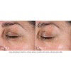 NEOSTRATA Skin Active Tri-Therapy Lifting Serum 30mL