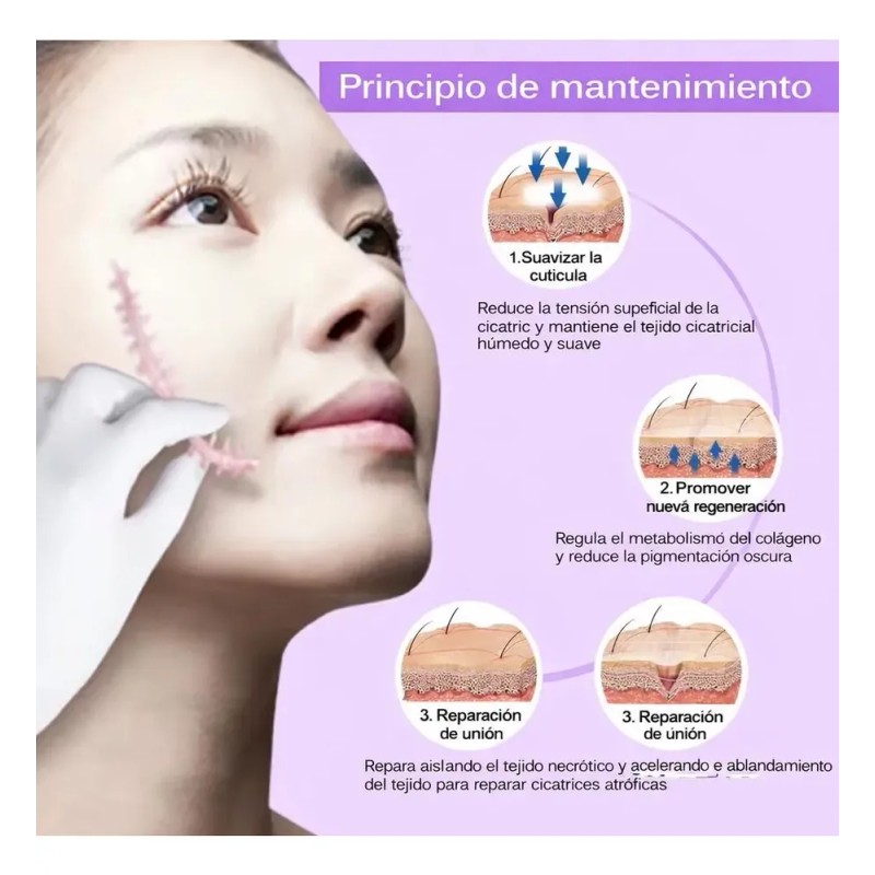 Crema Para Elimina Cicatrices Marcas Estrias Quemaduras Acne