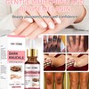 Dark Knuckle Whitening Serum, Whitening Serum Hand Knuckle Glow Serum