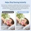 Anti Snoring Devices,Anti Snoring Mouth Guard Adjustable-Sleeping Snore Stopper Sleep