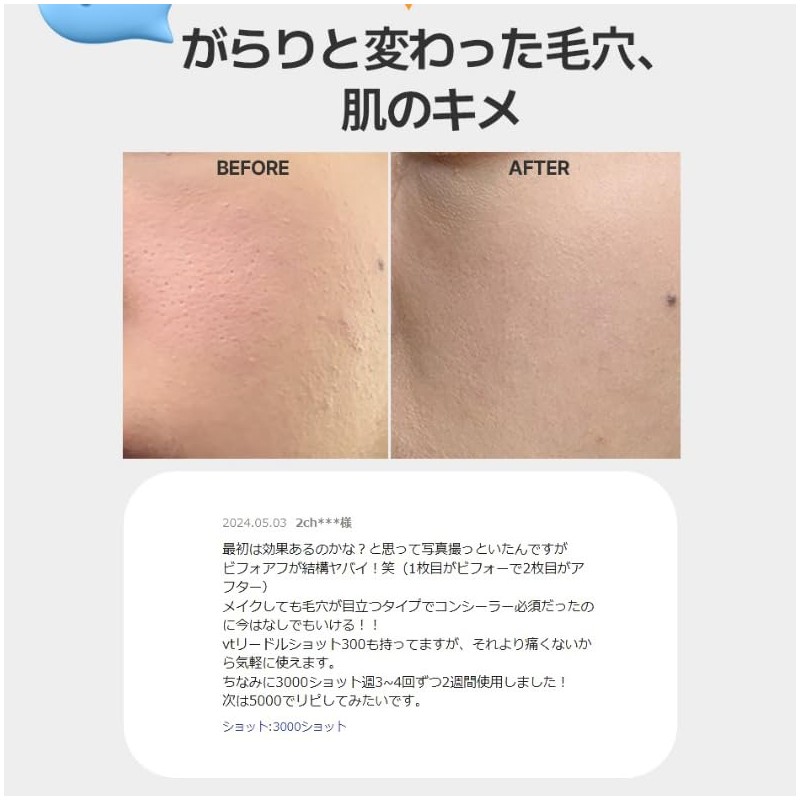 ECLIMOI Diamond Lift Shot 3000