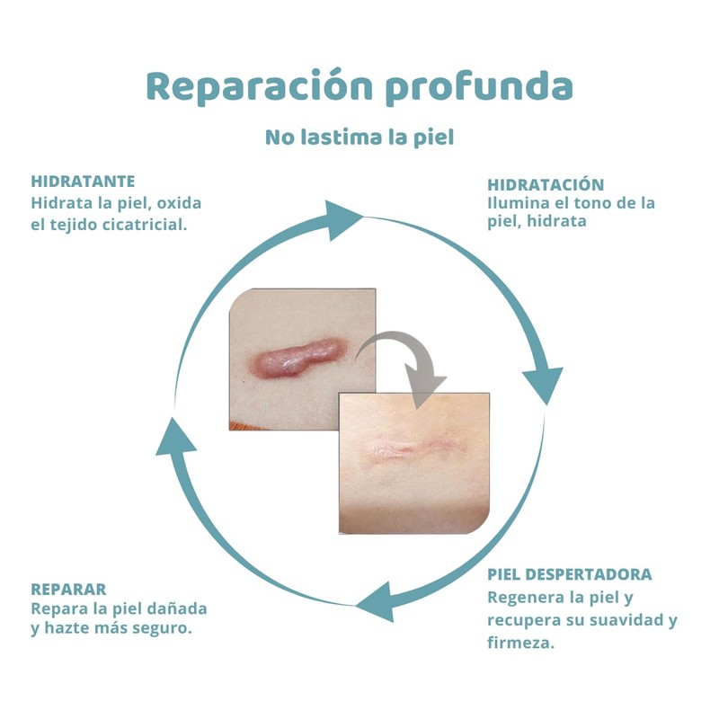 UNIVERSOENLÍNEA.COM | 5 Parches de Silicona para Cicatrices – Suaviza