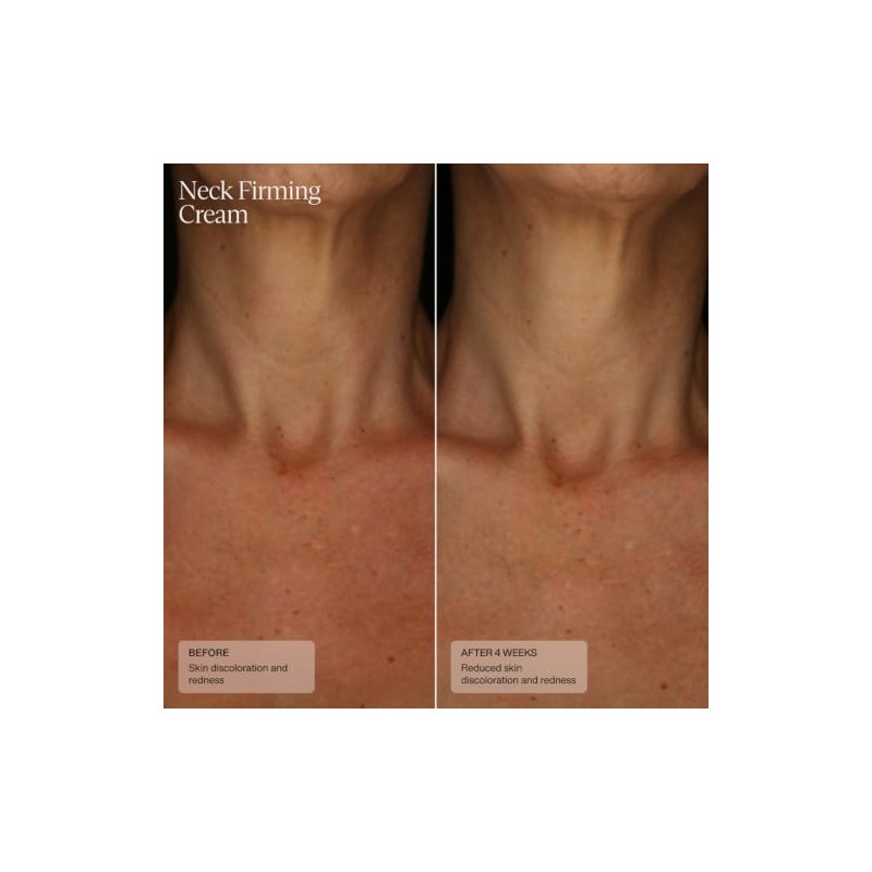 Sente Crema Reafirmante Para El Cuello Senté Para Piel Arrugada