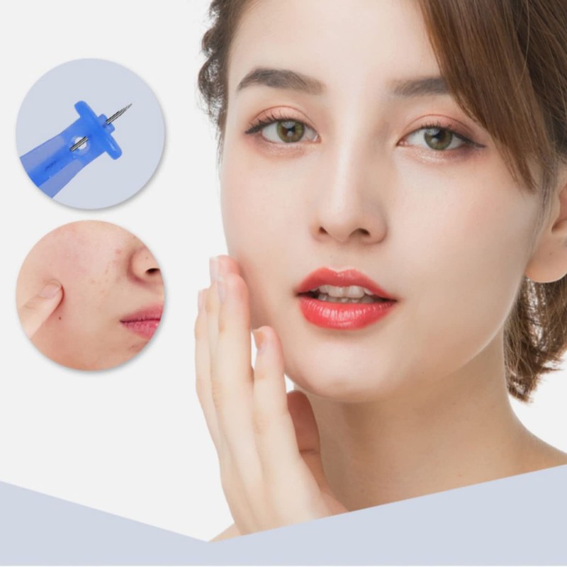 Professional 50pcs Disposable Blackhead and Blemish Remover Tools for Acne,