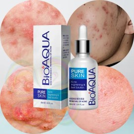 Serum Facial Pure Skin Retira Acné Espinillas Regenera Full                                                                                           