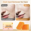 HOYEHOLA Kojic Acid Turmeric Soap Bar - Dark Spot Remover