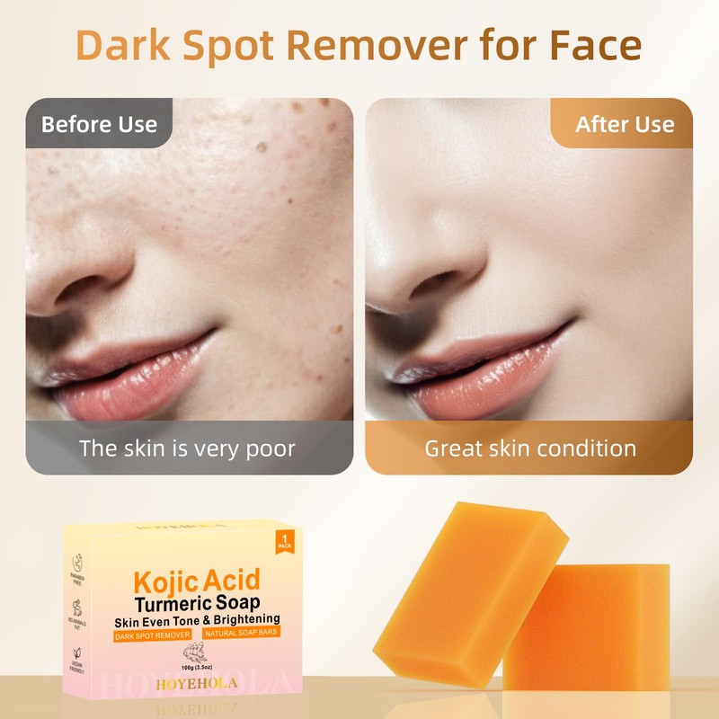 HOYEHOLA Kojic Acid Turmeric Soap Bar - Dark Spot Remover