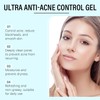 Bluemega Gel Hidratante con Niacinamida para el Acné