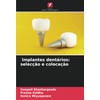 Implantes dentários: selecção e colocação