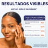 Palmer Skin Success Crema Antimanchas Oscuras Onzas