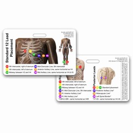 12 Lead EKG Placement Horizontal Badge Reference Card (1 Card)