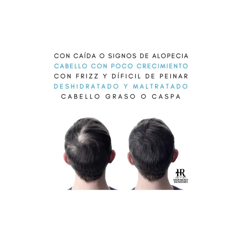 6 Shampoo Crecimiento Anticaída Reparador 7en1 Paquete Mixto