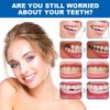 OFFCUP Temporary Tooth Filling, Tooth Filling Repair Kit, Dental Repair