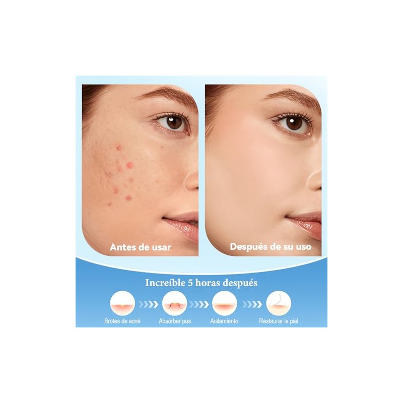 Parches para Acne,Pimple Patch,Parches para el acn con forma de