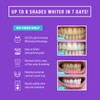 iSmile Teeth Whitening Kit - LED Light, 35% Carbamide Peroxide,