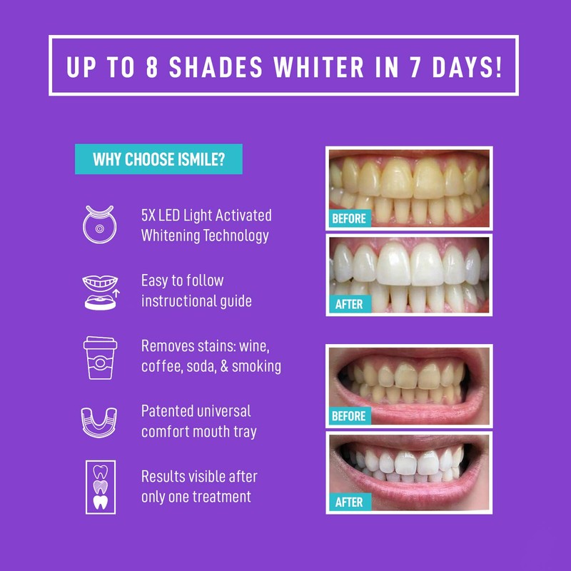 iSmile Teeth Whitening Kit - LED Light, 35% Carbamide Peroxide,