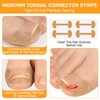 Benaewa 118 Pcs Ingrown Toenail Treatment Kit, Includes Ingrown Toenail